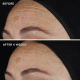 AGELESS+ retinol pure liquid retinol 0.1% 