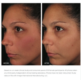 Ormedic balancing antioxidant serum