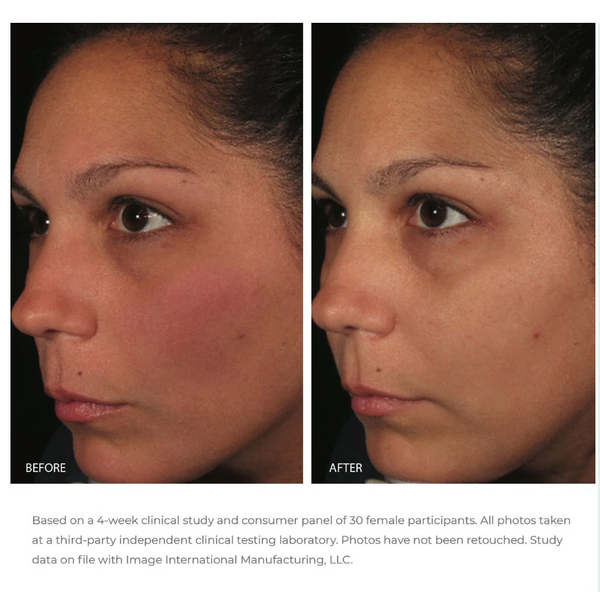 Ormedic balancing antioxidant serum