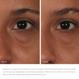 Ormedic Balancing Eye Lift Gel