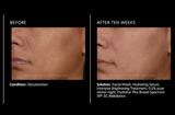 Retinol Solutions Intensive Brightening Treatment